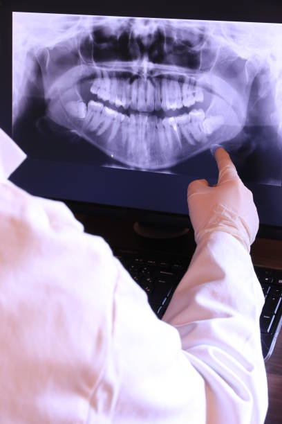 Best Emergency Tooth Extraction in Berlin, NJ